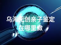 乌海无创亲子鉴定在哪里做