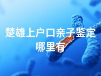 楚雄上户口亲子鉴定哪里有