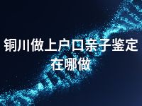 铜川做上户口亲子鉴定在哪做