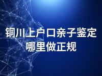 铜川上户口亲子鉴定哪里做正规