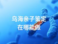 乌海亲子鉴定在哪能做