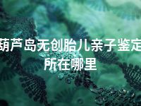 葫芦岛无创胎儿亲子鉴定所在哪里