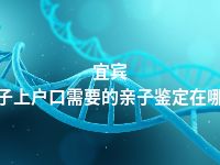 宜宾孩子上户口需要的亲子鉴定在哪做